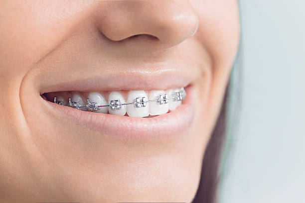 Best Wisdom Tooth Removal  in Byrdstown, TN